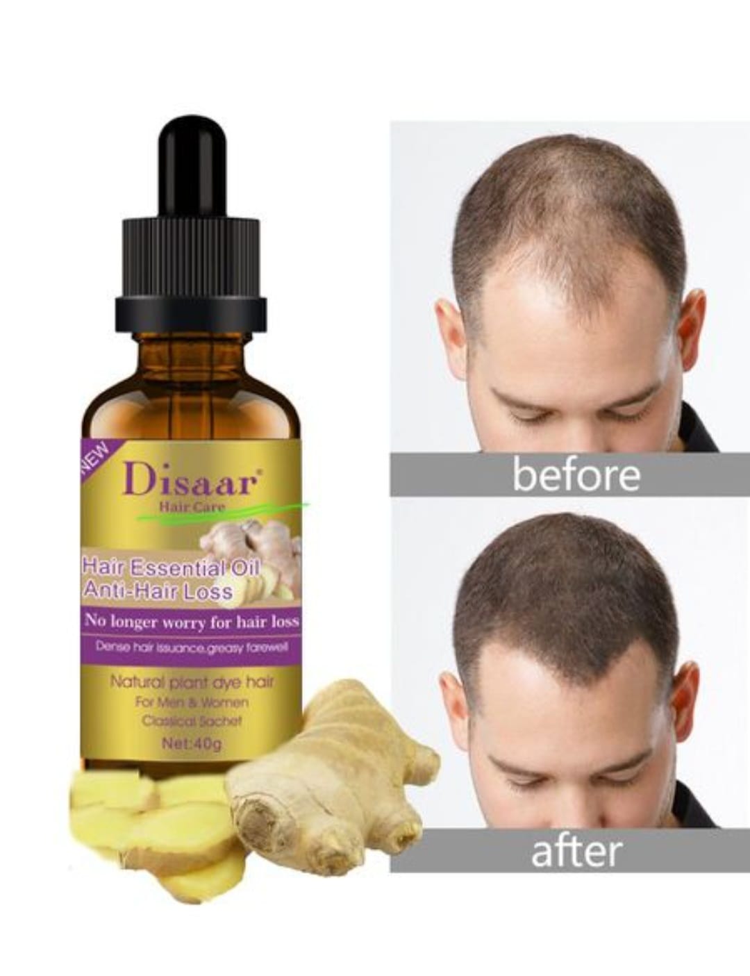 ¡Compra 1 y recibe 1 gratis! - Aceite Fortalecedor Capilar JengibreVital™